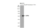 ATF4 Recombinant Rabbit Monoclonal Antibody (HL3514)