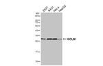 GCLM Recombinant Rabbit Monoclonal Antibody (HL3517)