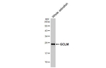 GCLM Antibody in Western Blot (WB)