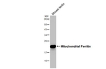 FTMT Antibody in Western Blot (WB)
