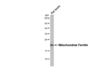 FTMT Antibody in Western Blot (WB)