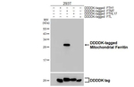 FTMT Recombinant Rabbit Monoclonal Antibody (HL3521)