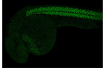 MYOD Recombinant Rabbit Monoclonal Antibody (HL3533)