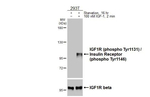 Phospho-IGF1R beta (Tyr1131, Tyr1146) Antibody in Western Blot (WB)