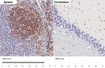 CXCR5 Antibody in Immunohistochemistry (Paraffin) (IHC (P))
