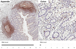 CXCR5 Antibody in Immunohistochemistry (Paraffin) (IHC (P))