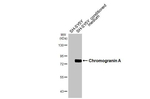 CHGA Recombinant Rabbit Monoclonal Antibody (HL3576)