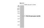 Phospho-PRKAR2A (Ser99) Recombinant Rabbit Monoclonal Antibody (HL3583)