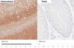 NLGN3 Antibody in Immunohistochemistry (Paraffin) (IHC (P))