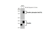 Phospho-Paxillin (Ser273) Antibody in Western Blot (WB)