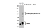Phospho-Paxillin (Ser273) Recombinant Rabbit Monoclonal Antibody (HL3588)