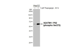 Phospho-SQSTM1 (Ser272) Antibody in Western Blot (WB)