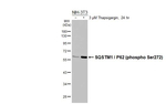 Phospho-SQSTM1 (Ser272) Recombinant Rabbit Monoclonal Antibody (HL3591)