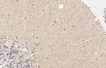 CD51 Antibody in Immunohistochemistry (Paraffin) (IHC (P))