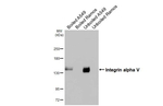 CD51 Antibody in Western Blot (WB)