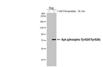 Phospho-Syk (Tyr525, Tyr526) Antibody in Western Blot (WB)