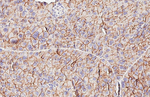 VPAC2 Antibody in Immunohistochemistry (Paraffin) (IHC (P))