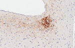 VPAC2 Antibody in Immunohistochemistry (Paraffin) (IHC (P))