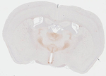 VPAC2 Antibody in Immunohistochemistry (Paraffin) (IHC (P))