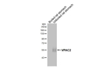 VPAC2 Antibody in Western Blot (WB)