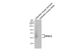 VPAC2 Antibody in Western Blot (WB)