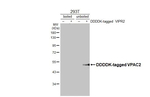 VPAC2 Antibody in Western Blot (WB)