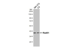 RAD51 Antibody in Western Blot (WB)