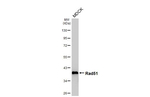 RAD51 Antibody in Western Blot (WB)
