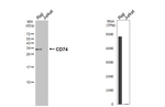 CD74 Antibody in Western Blot (WB)