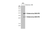 Enterovirus D68 VP2 Antibody in Western Blot (WB)