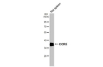 CCR5 Antibody in Western Blot (WB)