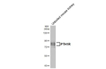 PTH1R Antibody in Western Blot (WB)