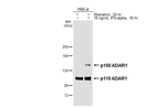 ADAR1 Antibody in Western Blot (WB)
