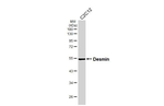 Desmin Antibody in Western Blot (WB)