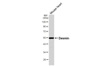 Desmin Antibody in Western Blot (WB)