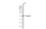 Desmin Antibody in Western Blot (WB)