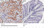 ORP8 Antibody in Immunohistochemistry (Paraffin) (IHC (P))
