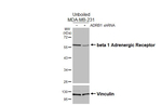 beta-1 Adrenergic Receptor Recombinant Rabbit Monoclonal Antibody (HL3678)
