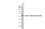 beta-1 Adrenergic Receptor Antibody in Western Blot (WB)