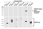 beta-1 Adrenergic Receptor Antibody in Western Blot (WB)