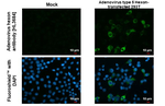 Adenovirus Hexon Recombinant Rabbit Monoclonal Antibody (HL3684)