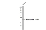 FTMT Antibody in Western Blot (WB)