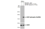Phospho-ASK1 (Ser966) Antibody in Western Blot (WB)