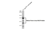 Yellow Fever Virus NS3 Antibody in Western Blot (WB)