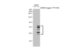 Yellow Fever Virus NS3 Antibody in Western Blot (WB)
