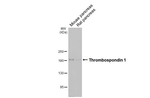 Thrombospondin 1 Antibody in Western Blot (WB)