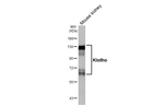 Klotho Antibody in Western Blot (WB)