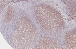 CXCR5 Antibody in Immunohistochemistry (Paraffin) (IHC (P))