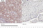 CXCR5 Antibody in Immunohistochemistry (Paraffin) (IHC (P))