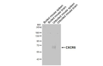 CXCR5 Antibody in Western Blot (WB)